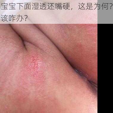 宝宝下面湿透还嘴硬，这是为何？该咋办？