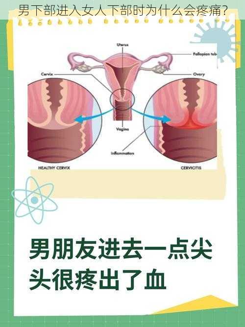 男下部进入女人下部时为什么会疼痛？